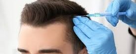 FUE vs. FUT: Hair Transplant Methods Available in Riyadh