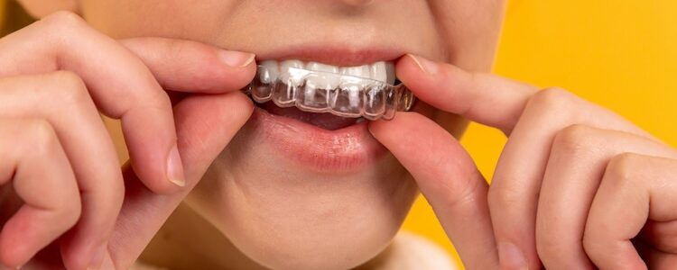 How Can Dentists Effectively Address Bruxism With Night Guards