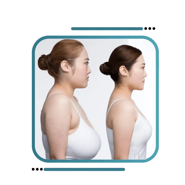 Everything You Need to Know About Breast Reduction in India